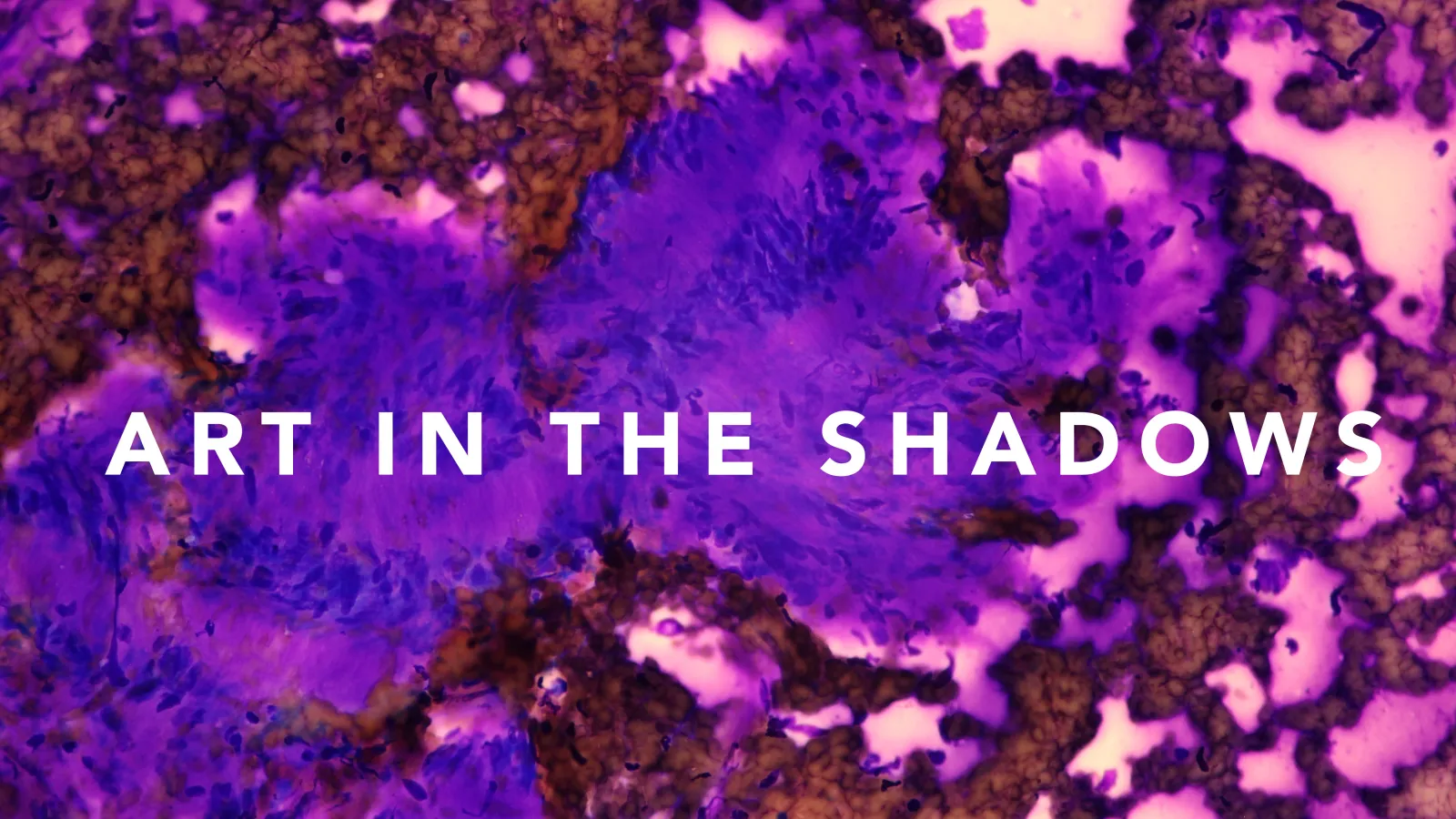 Art in the Shadows